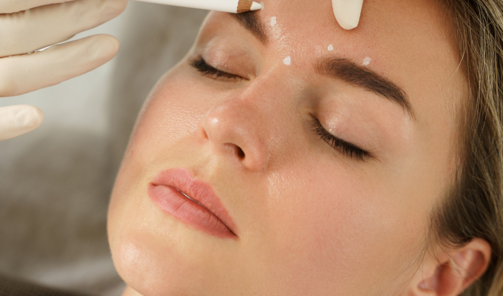 A woman with closed eyes lies back as a gloved hand marks dots above her eyebrow with a white pencil, possibly preparing for a cosmetic procedure. Her expression is calm and relaxed.